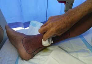 Read more about the article Diabetes Symptoms And Cures