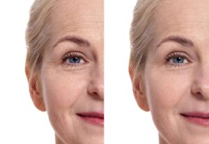 Read more about the article Preventing Your Age From Showing Up on Your Face