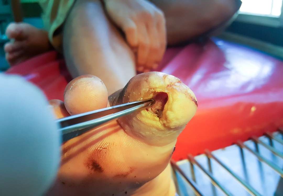 You are currently viewing 7 Diabetes Foot Care Tips