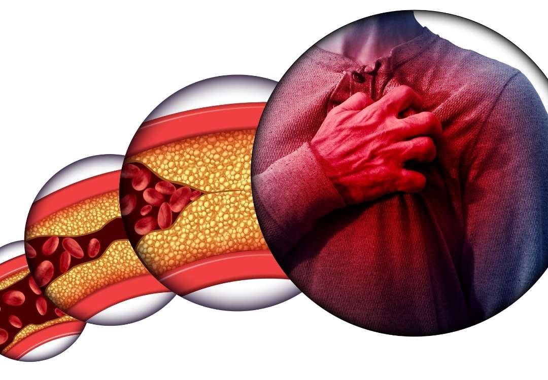 You are currently viewing An Overview of Heart Disease