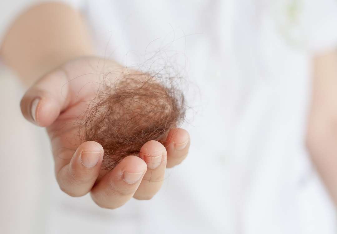 You are currently viewing A Cure For The Age Old Problem Of Hair Loss