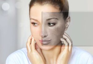 Read more about the article Is l glutathione good for skin whitening
