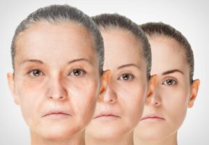 Read more about the article How to improve wrinkles on face?