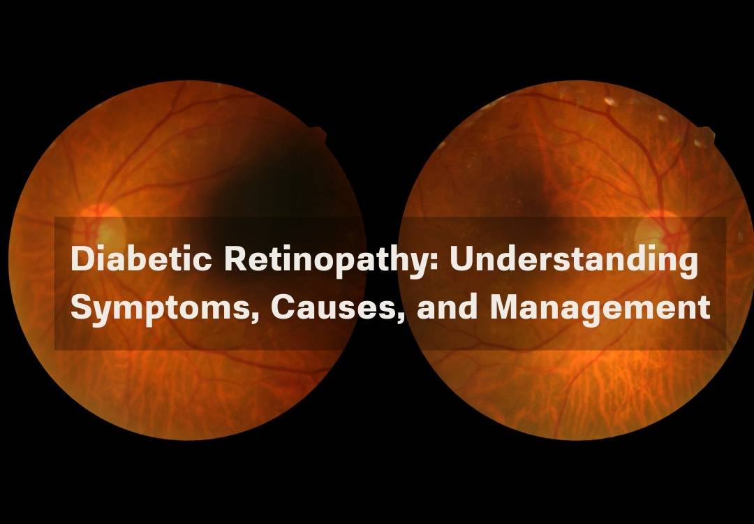 You are currently viewing Diabetic Retinopathy: Understanding Symptoms, Causes, and Management