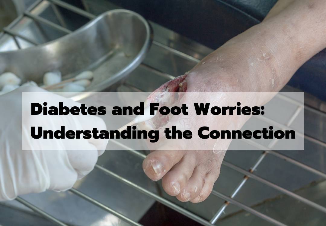 You are currently viewing Diabetes and Foot Worries
